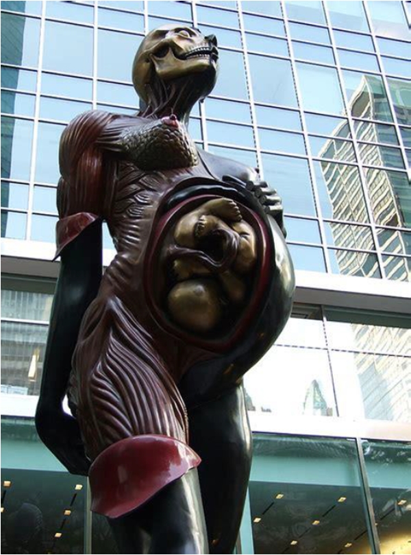  6: D. HIRST, The Virgin Mother (2005, Cortile della Londons Royal Academy)